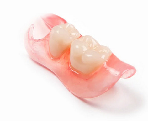 Что влияет на стоимость зубного протеза бабочка?