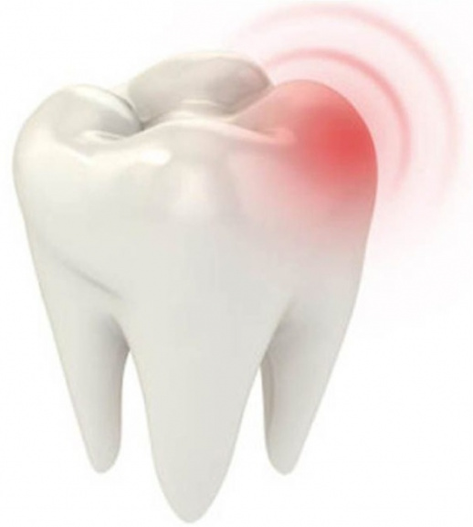 Что делать при сильной и острой зубной боли?