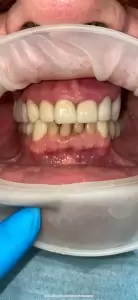 Фотография Апекс 2