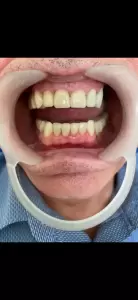 Фотография Апекс 1