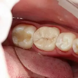 Фотография Виктория 2