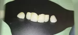 Фотография 32 друга 5